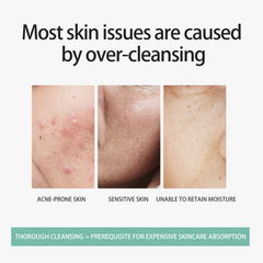 Acid Mousse Facial Rose Foam Cleanser